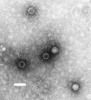 Poliovirus im Elektronenmikroskop