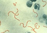 Streptococcus pyogenes (Papenheim-Färbung)