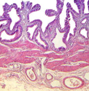 Wand der Gallenblase, H.E.-gefärbt