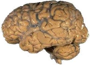 Ein menschliches Gehirn