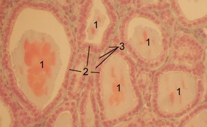 Histologische Aufnahme der Schilddrüse eines Pferdes. 1 Follikel mit Kolloid, 2 Follikelepithelzellen, 3 Endothelzellen der Kapillaren.