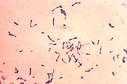 Corynebacterium diphtheriae