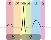 Schematische Darstellung eines EKG mit Bezeichnungen