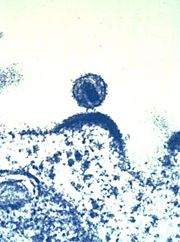Sich aus einer Immunzelle herauslösendes HI-Virus.