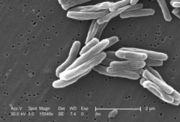 Elektronenmikroskopische Aufnahme der Tuberkelbakterien