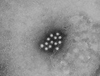 Virion des Hepatitis-A-Virus