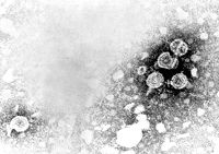 Virionen und leere Partikel des Hepatitis-B-Virus