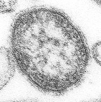 Masernvirus in der Transmissions-Elektronen- Mikroskopie (TEM)