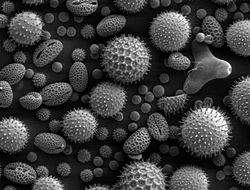 Pollen (elektronenmikroskopische Aufnahme) sind Auslöser des Heuschnupfens (Pollinosis).