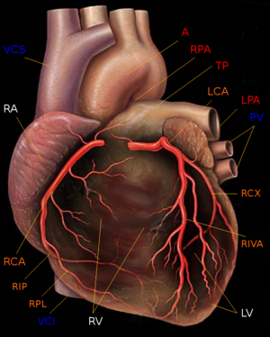 Grafische Darstellung des menschlichen Herzens mit Ansicht von vorne (ventral). Dargestellt sind: - Herzkammern und -vorhöfe (weiß):  rechter Ventrikel (RV), rechter Vorhof (RA) und linker Ventrikel (LV). Der linke Vorhof wird durch den linken Ventrikel verdeckt.  - Arterien (rot) und Venen (blau) des großen und kleinen Kreislaufs: Aortenbogen der Aorta (A), Truncus pulmonalis (TP) mit linker und rechter Pulmonalarterie (RAP und LAP)  sowie Vena cava superior und inferior (VCS und VCI) sowie die linken Pulmonalvenen (PV).Die rechten Pulmonalvenen sind durch den rechten Ventrikel verdeckt.  - Koronararterien (orange): Hauptstamm der linken Koronararterie (LCA) mit den Hauptästen Ramus circumflexus (RCX) und Ramus interventricularis anterior (RIVA) sowie der Hauptstamm der rechten Koronararterie mit den Hauptästen Ramus interventricularis posterior (RIP) und Ramus posterolateralis (RPL). Die Koronarvenen sind nicht dargestellt.
