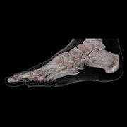 Menschlicher Fuß, Volumenrekonstruktionstechnik aus CT-Bildern (Video)