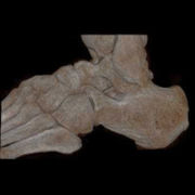 Menschlicher Fuß, hochauflösende Volumenrekonstruktionstechnik aus CT (Video)