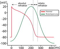 Bild:Muskelreiz-herz.svg